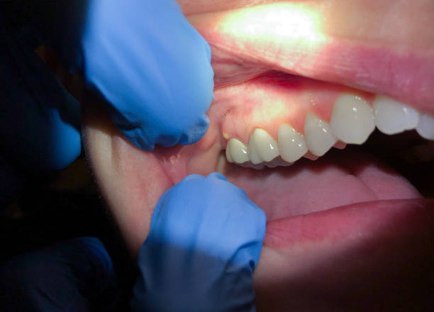Best Emergency Dental Services for Seniors in Flandreau, SD